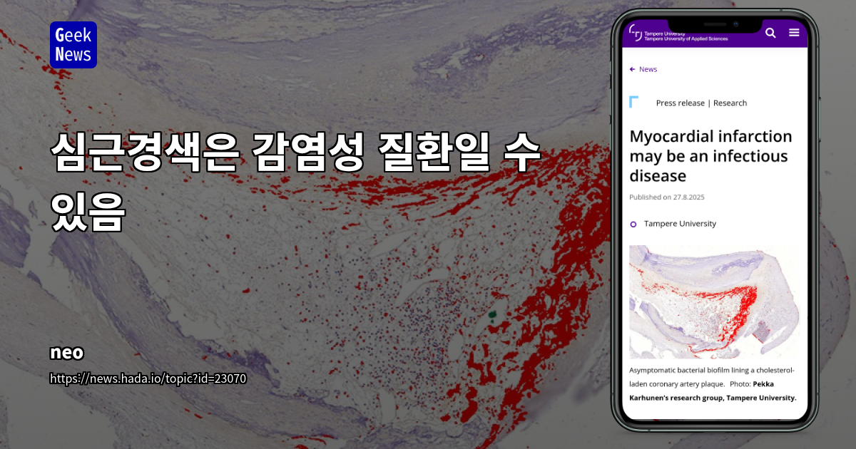 심근경색, 감염성 요인에 의한 플라크 파열 메커니즘 규명: 새로운 진단 및 예방 전략의 가능성